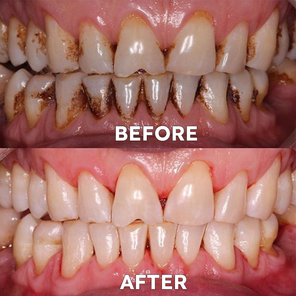 Official Store | Ourlyard™ Tooth Health Mineral Powder - TGA-Certified