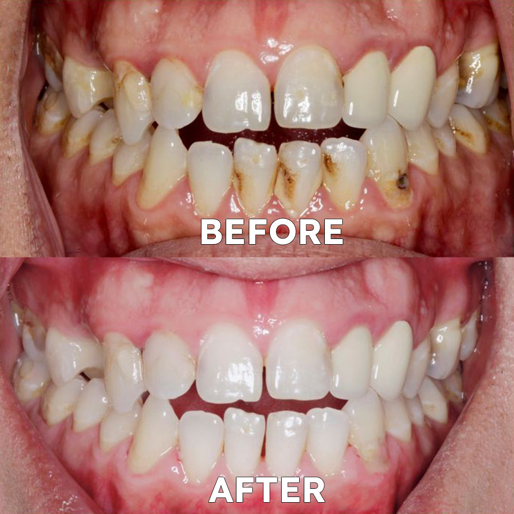 Official Store | Ourlyard™ Tooth Health Mineral Powder - TGA-Certified