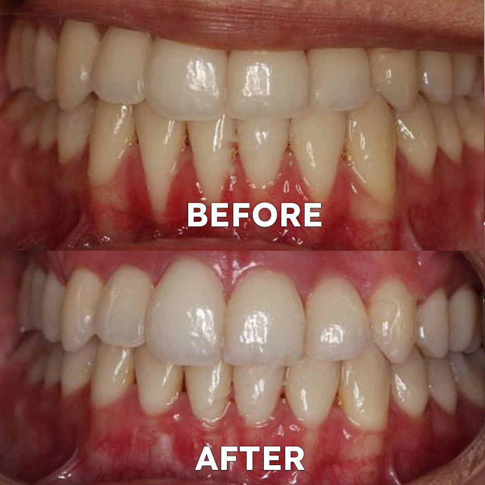 Official Store | Ourlyard™ Tooth Health Mineral Powder - TGA-Certified